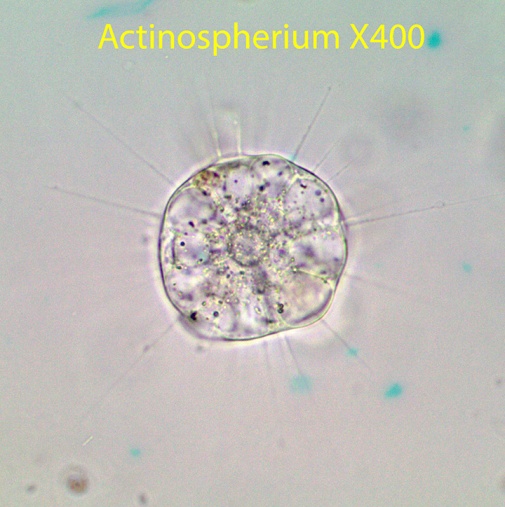 Amoeba Actinospherium spp