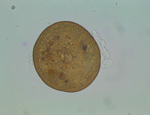 Amoeba Arcella spp. X400