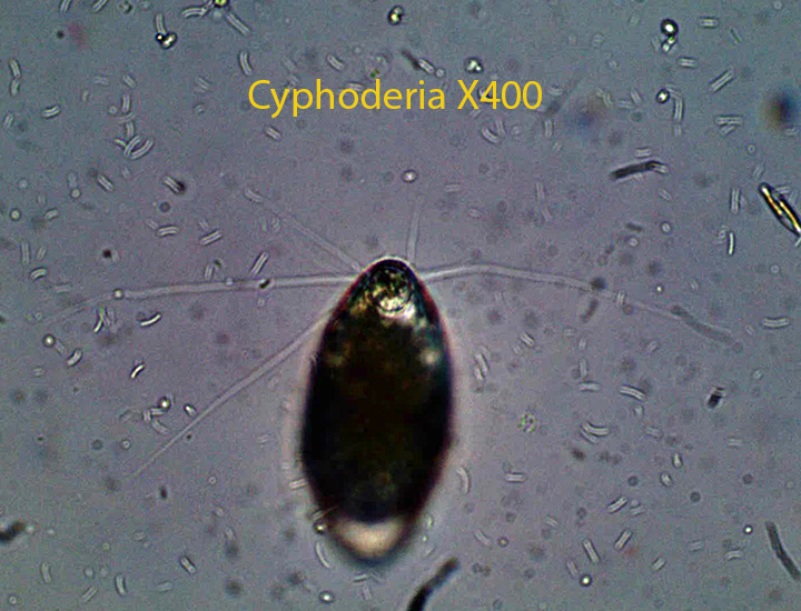 Amoeba Cyphoderia spp