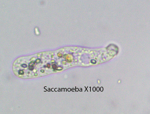 Amoeba Saccamoeba spp