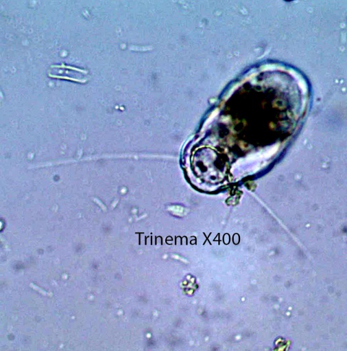 Amoeba Trinema spp