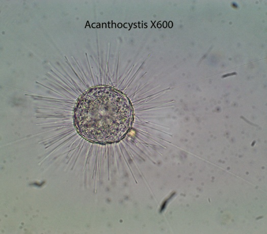 Heliozoa Acanthocystis spp