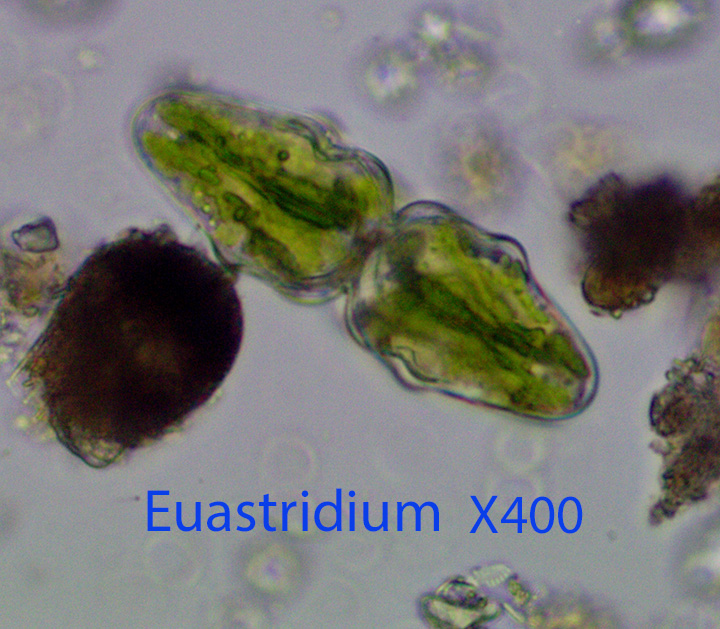 desmid-euastridium-spp-x400-bp-cathance-7-21-2014-copy