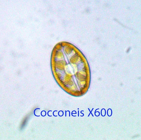 diatom-cocconeis-x600-12-baybridge-intertidal-9-11-2014