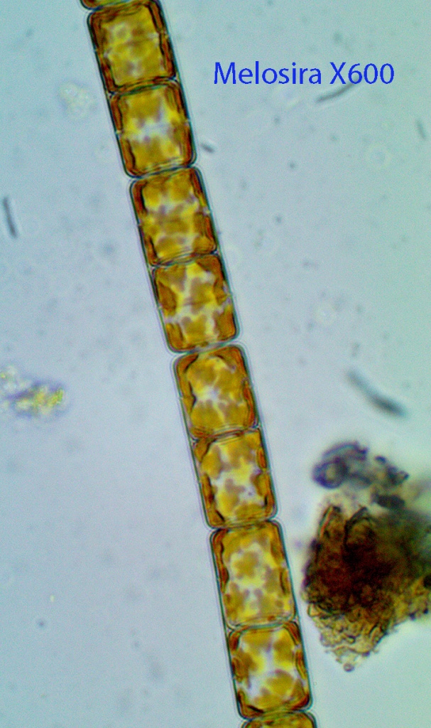diatom-melosira-spp