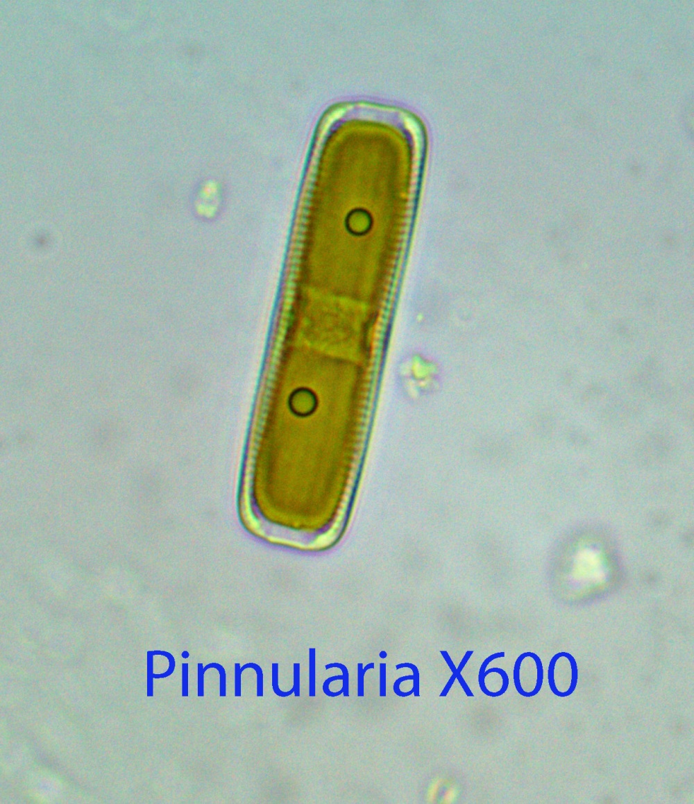 Diatom Pinnularia spp.jpg