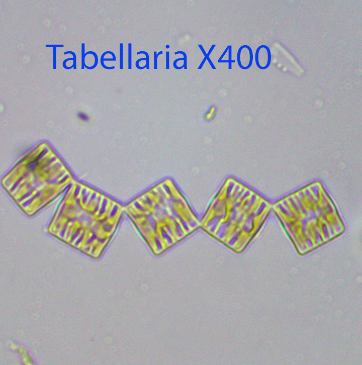 Diatom Tabellaria spp.jpg